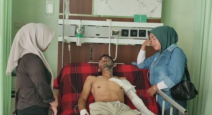 Salah satu korban penyiraman cairan kimia
